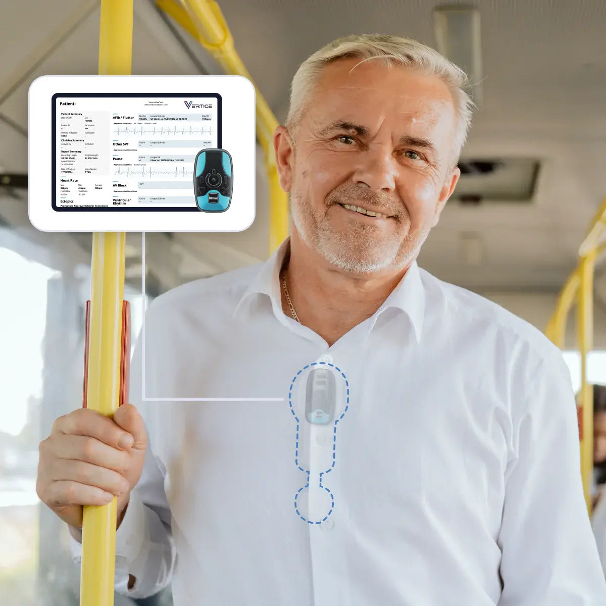 ECG Heart Monitor - Track Your Heart Health | Goodbody Clinic