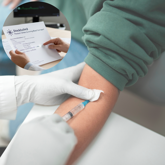 Stockholm3 Prostate Cancer Screening Blood Test