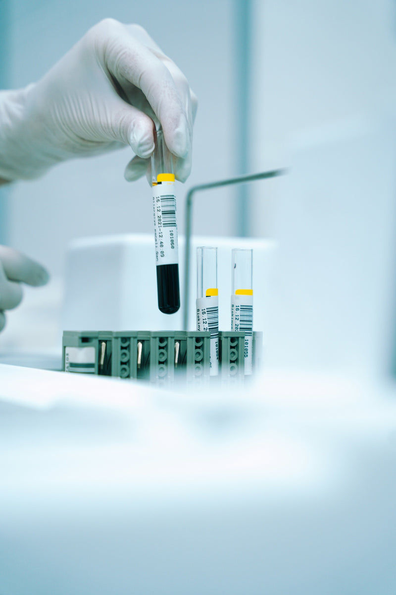 Blood sample tubes ready for testing